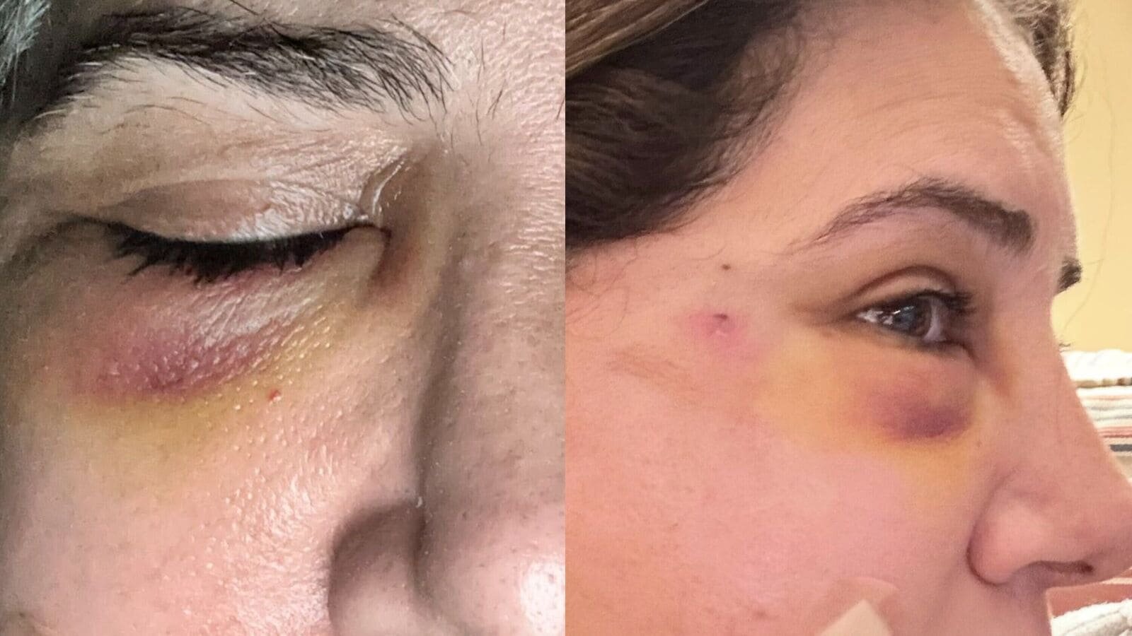 Pakistani journalist Jasmeen Manzoor accused her ex-husband of physically assaulting her