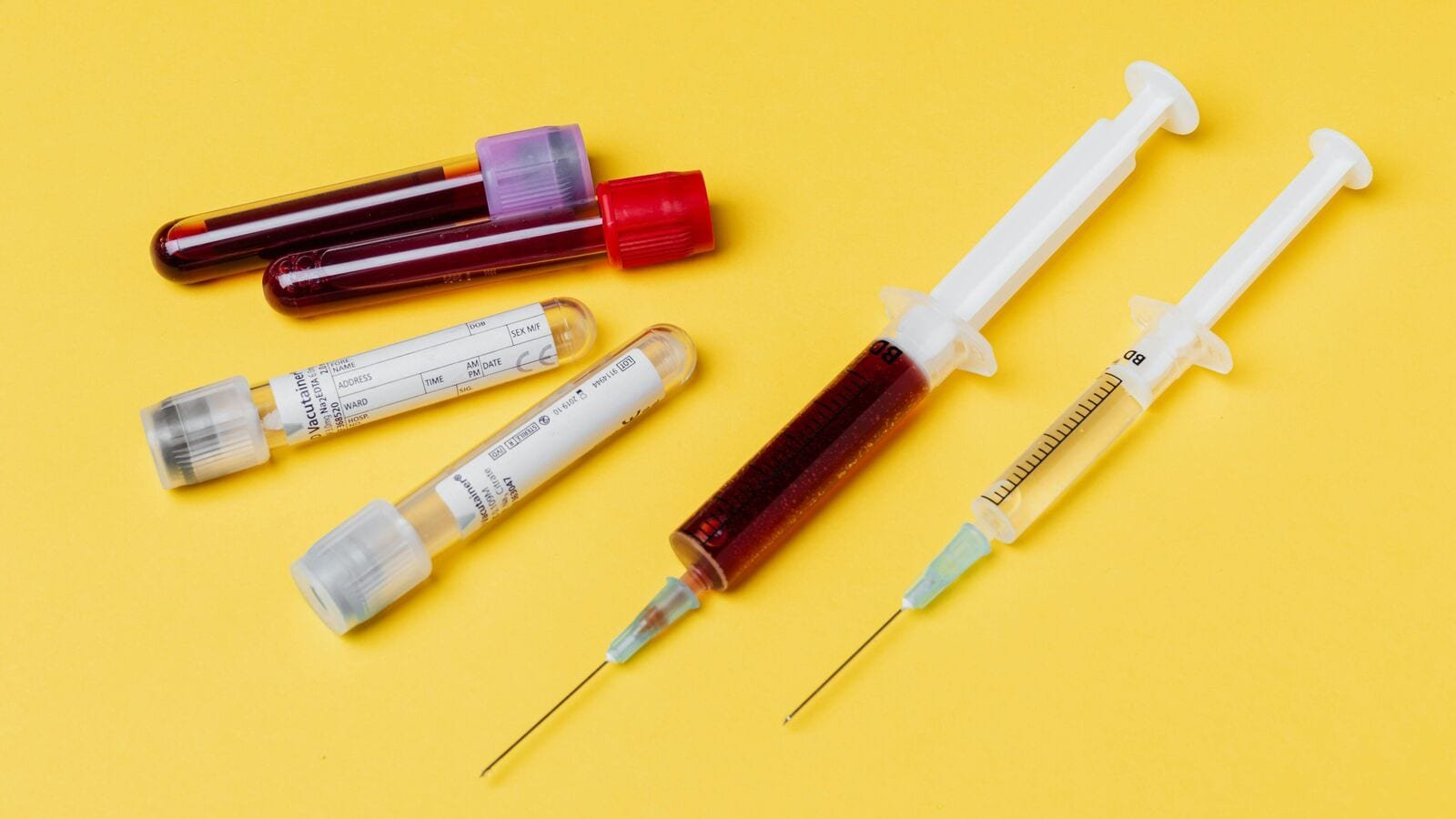 Bizarre: Teacher forces female students to donate blood, sometimes thrice a day, for academic credit