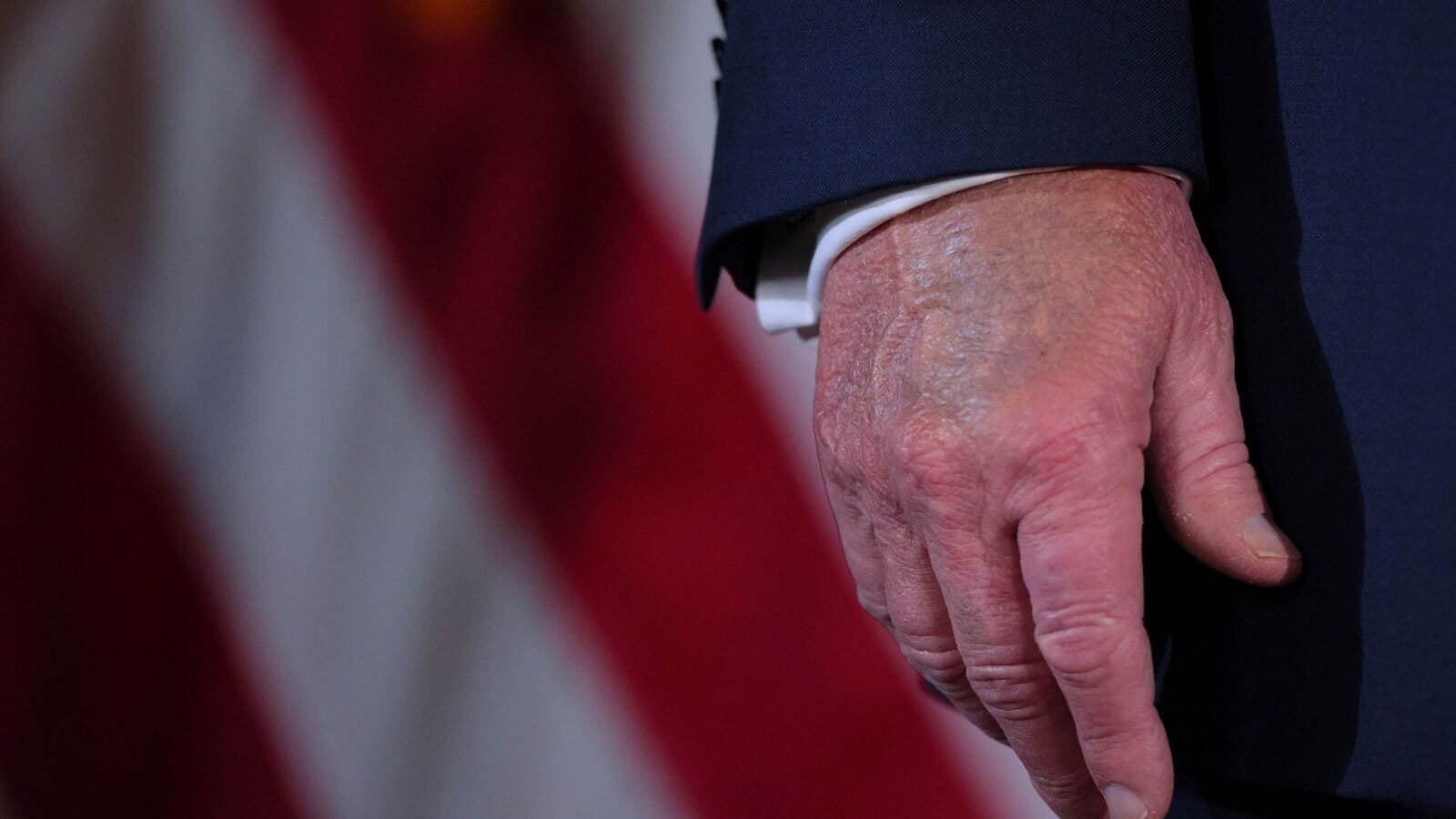 Make-up covers the back of the right hand of U.S. President-Donald Trump while he makes remarks and takes questions from reporters at his residence at Mar-a-Lago in Palm Beach, Florida, U.S., December 16, 2024.  REUTERS/Brian Snyder/File Photo