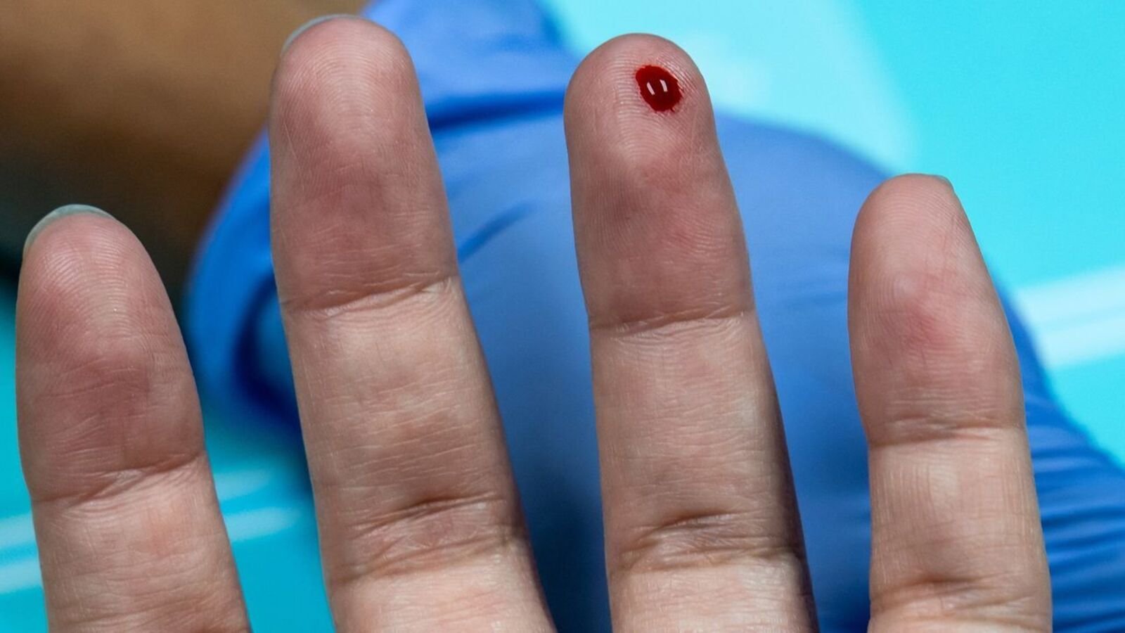 The intruder gained entry by pushing the door open and knocked Yu using a black cloth soaked in anaesthetics. (WSJ)