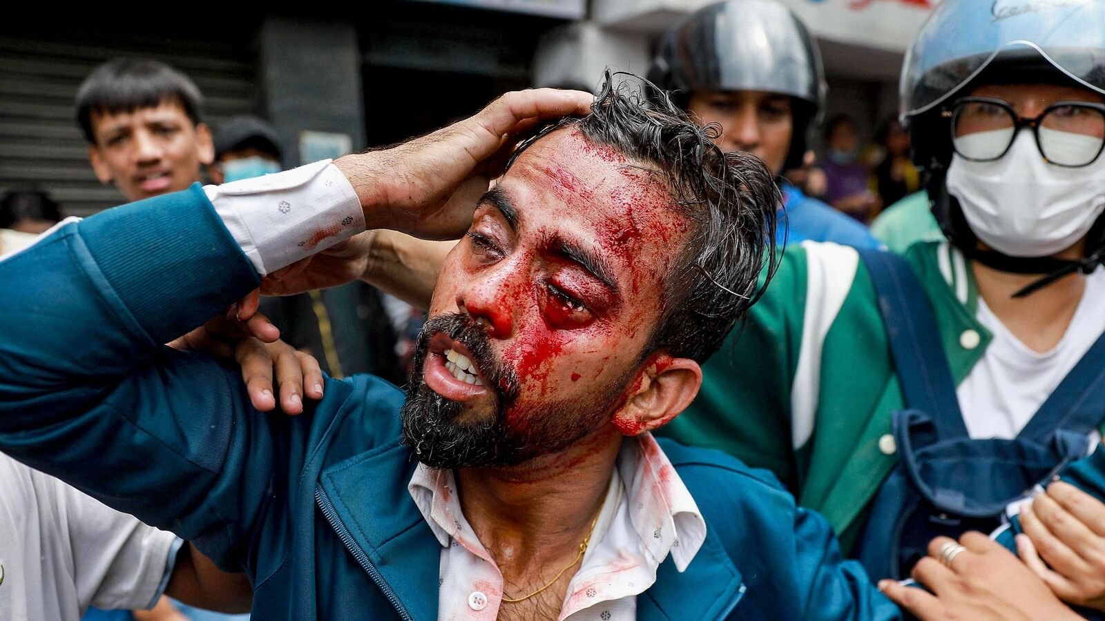 नेपाल विरोध प्रदर्शन: हम अब तक 9 मारे गए, 42 घायल होने के कारण सोशल मीडिया बैन पर घायल हुए, 42 घायल